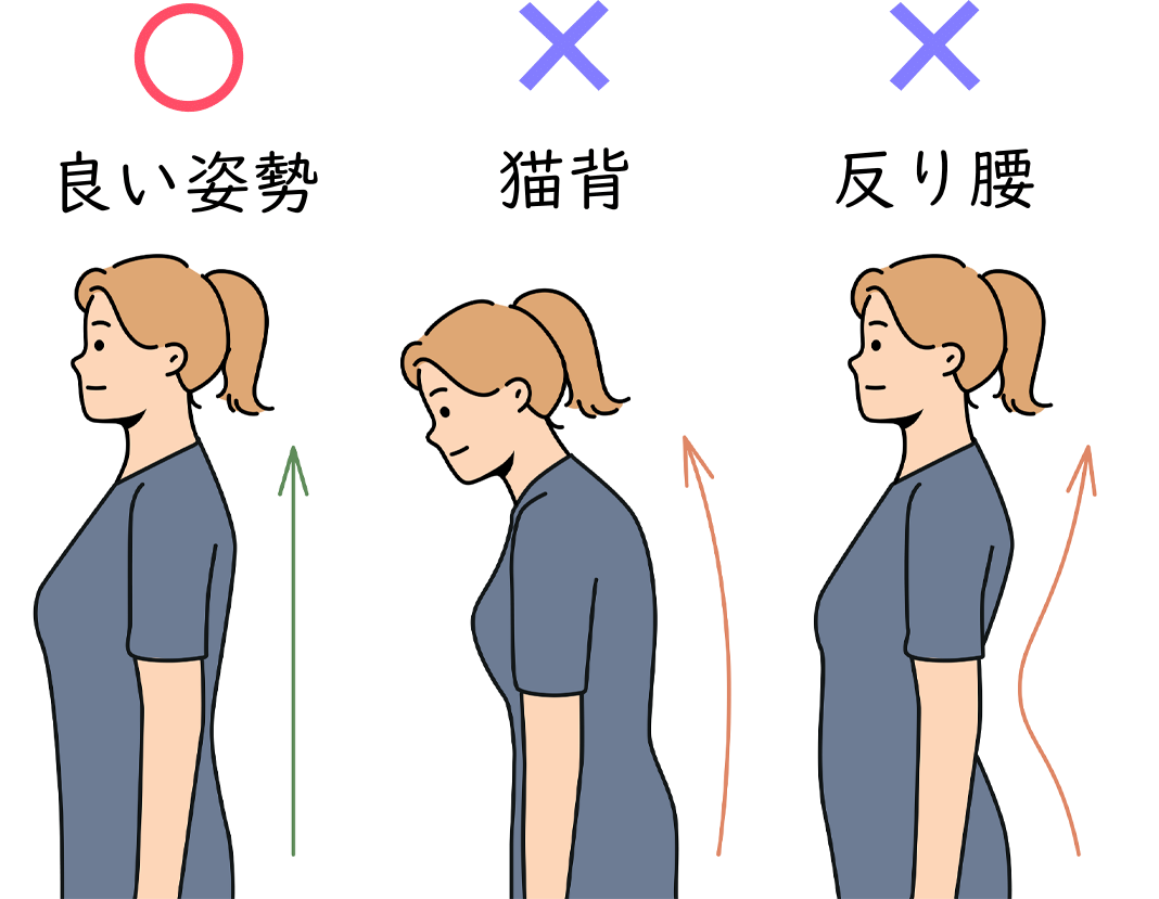 代表的な悪い姿勢